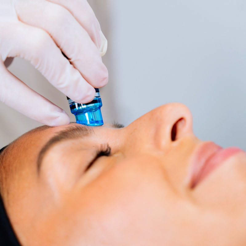 Hydrafacial & Massage Kobido Facekult 15min